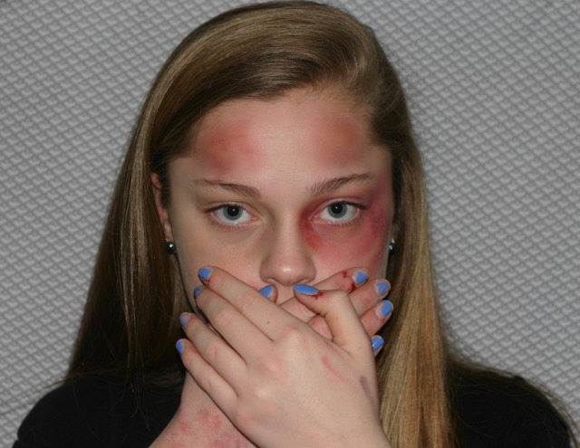 Edgerton+uses+makeup+and+photography+to+make+a+public+statement+about+domestic+violence
